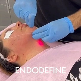 endodefine
