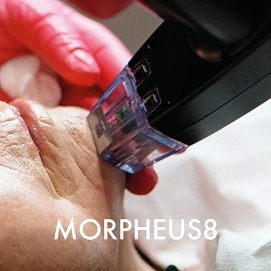 MORPHEUS8